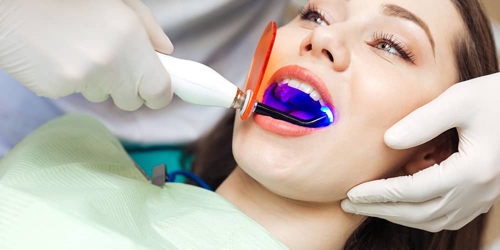 Term verwijderen: Hoeveel kost tanden bleken Hoeveel kost tanden bleken